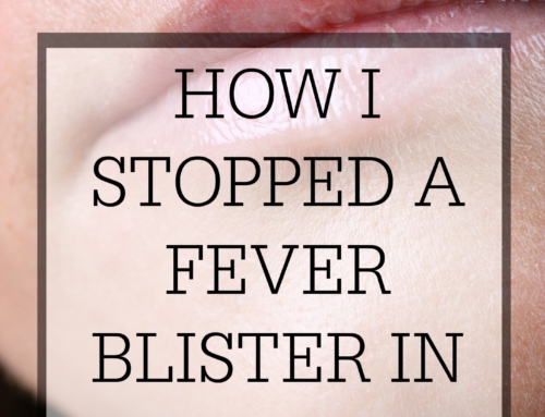 How I stopped a fever blister in its tracks